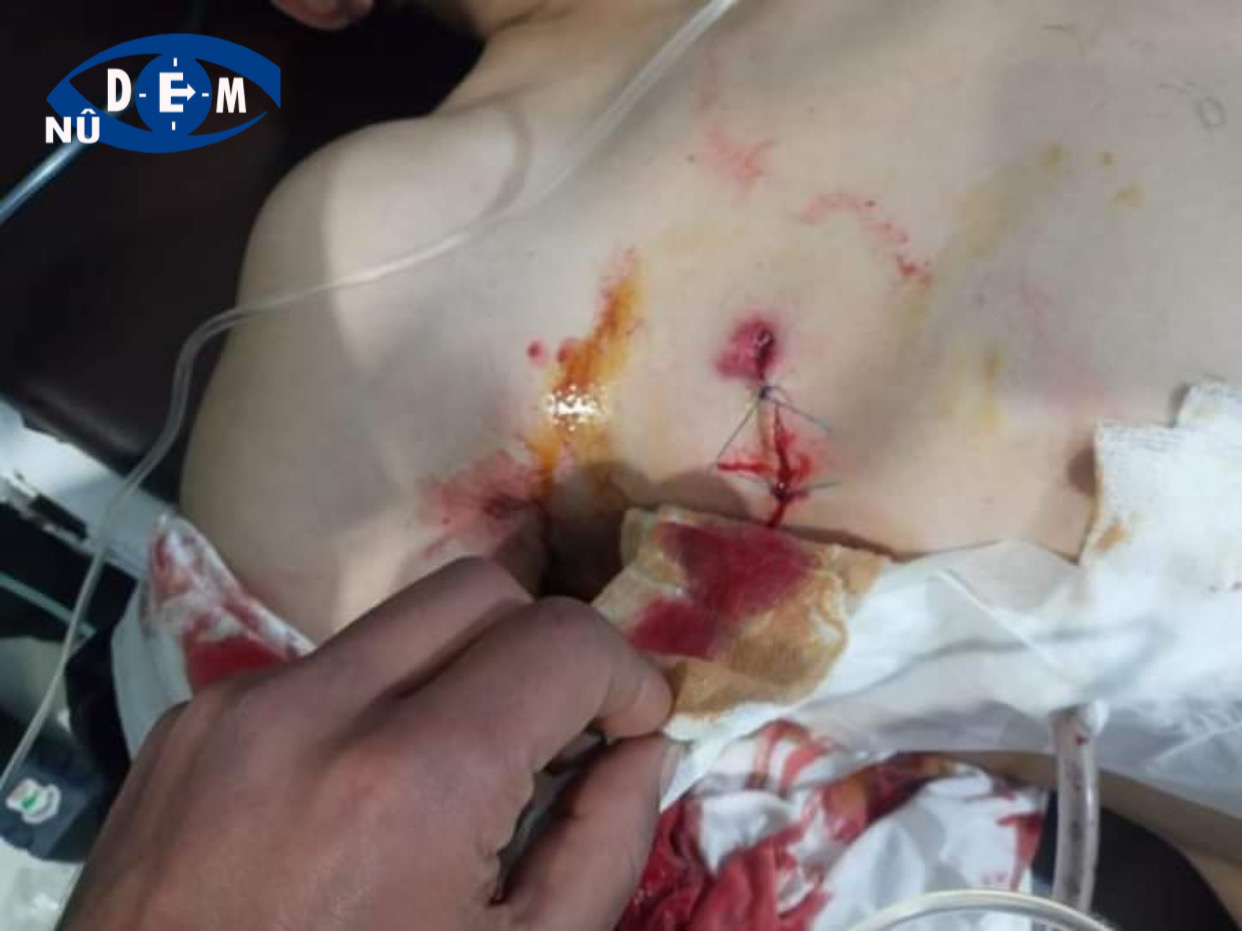 شجار يؤدي إلى اصابة شيخ عشيرة البوخميس