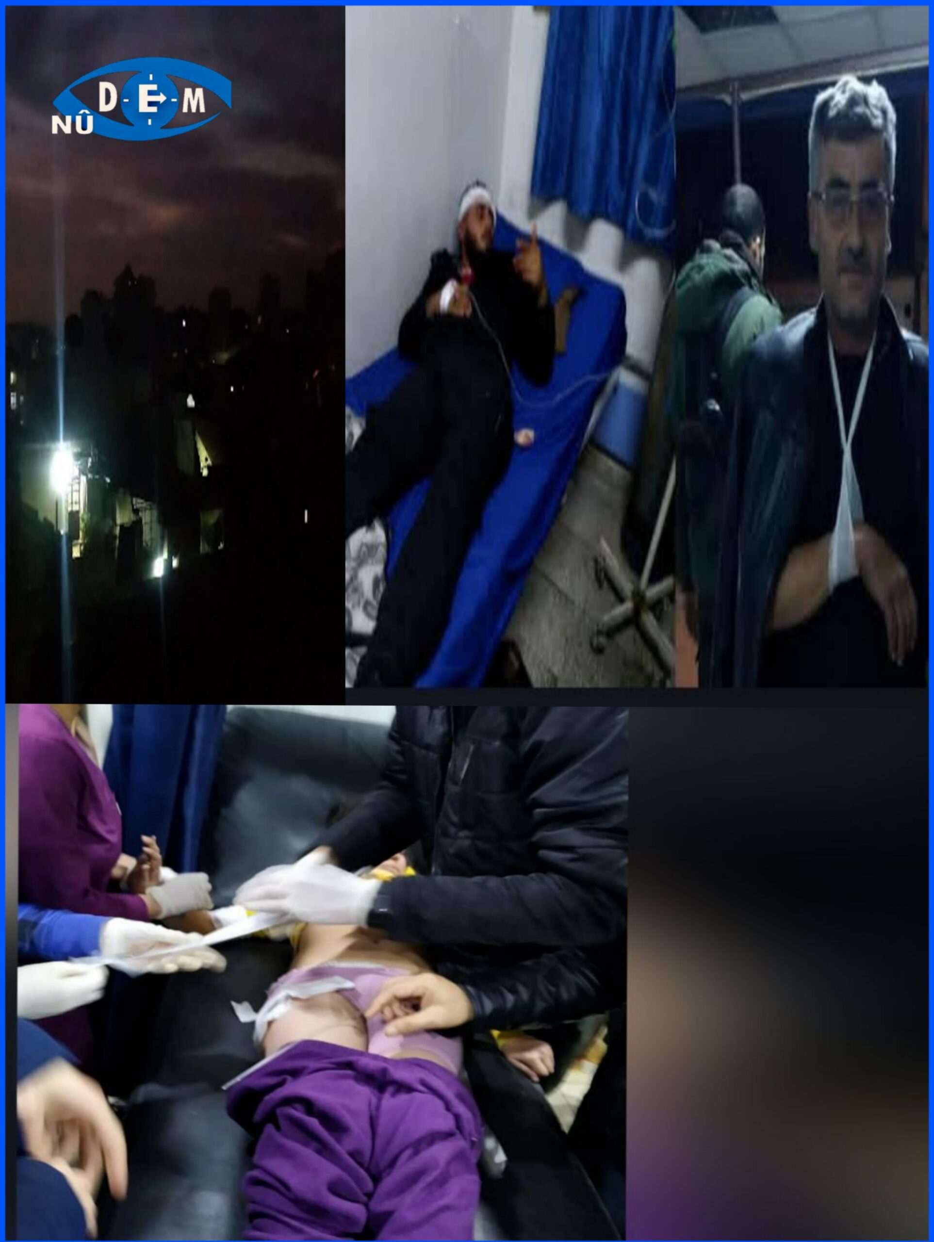 قصف مدفعي يطال أحياء سكنية في حلب ويوقع إصابات بين المدنيين